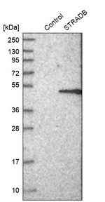 ALS2CR2 Antibody in Western Blot (WB)