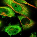 HSP105 Polyclonal Antibody