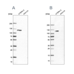 HSP105 Antibody in Western Blot (WB)