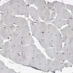 MRGPRF Antibody in Immunohistochemistry (Paraffin) (IHC (P))