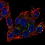 AMID Polyclonal Antibody