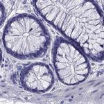 PSMB11 Antibody in Immunohistochemistry (Paraffin) (IHC (P))