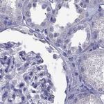 PSMB11 Antibody in Immunohistochemistry (Paraffin) (IHC (P))