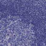 PSMB11 Antibody in Immunohistochemistry (Paraffin) (IHC (P))
