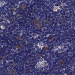 PSMB11 Antibody in Immunohistochemistry (Paraffin) (IHC (P))