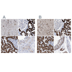 ALDH6A1 Antibody in Immunohistochemistry (Paraffin) (IHC (P))