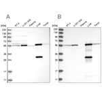 ALDH6A1 Antibody in Western Blot (WB)