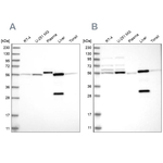 ALDH6A1 Antibody in Western Blot (WB)