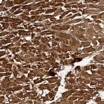 PTPRA Antibody in Immunohistochemistry (Paraffin) (IHC (P))