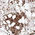 TRIM4 Polyclonal Antibody