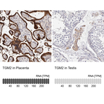 TGM2 Antibody in Immunohistochemistry (Paraffin) (IHC (P))