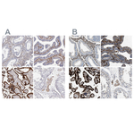 TGM2 Antibody in Immunohistochemistry (Paraffin) (IHC (P))