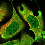 PRKD3 Polyclonal Antibody