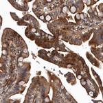 PRKD3 Antibody in Immunohistochemistry (Paraffin) (IHC (P))