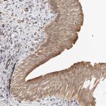 DTNBP1 Antibody in Immunohistochemistry (Paraffin) (IHC (P))