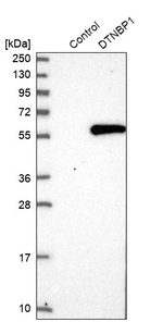 DTNBP1 Antibody in Western Blot (WB)