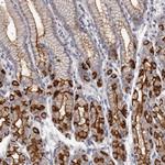 GPRC5C Antibody in Immunohistochemistry (Paraffin) (IHC (P))