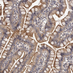 SLC22A1 Polyclonal Antibody