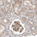 SLC22A1 Antibody in Immunohistochemistry (Paraffin) (IHC (P))