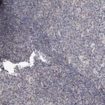 SLC22A1 Antibody in Immunohistochemistry (Paraffin) (IHC (P))