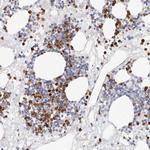 Cathelicidin Antibody in Immunohistochemistry (Paraffin) (IHC (P))
