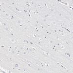 Cathelicidin Antibody in Immunohistochemistry (Paraffin) (IHC (P))