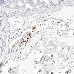 Cathelicidin Antibody in Immunohistochemistry (Paraffin) (IHC (P))
