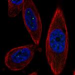 TSACC Polyclonal Antibody