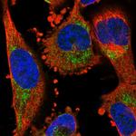 NPY1R Polyclonal Antibody