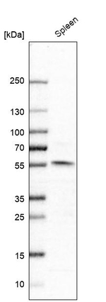 NPY1R Antibody in Western Blot (WB)