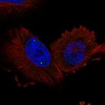 WRAP53 Polyclonal Antibody