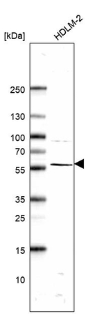 ABI1 Antibody in Western Blot (WB)