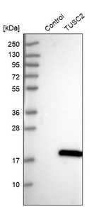 TUSC2 Antibody in Western Blot (WB)