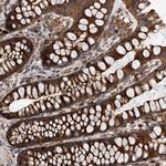 C21orf2 Polyclonal Antibody