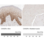 CAR Antibody in Immunohistochemistry (Paraffin) (IHC (P))