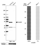 CAR Antibody in Western Blot (WB)