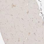 CAR Antibody in Immunohistochemistry (Paraffin) (IHC (P))