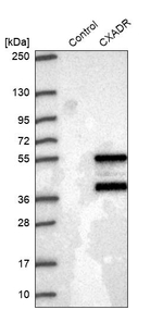 CAR Antibody in Western Blot (WB)