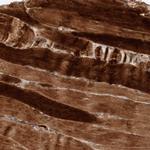 XPNPEP1 Antibody in Immunohistochemistry (Paraffin) (IHC (P))