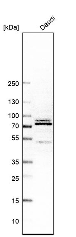 XPNPEP1 Antibody in Western Blot (WB)