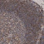 CD267 (TACI) Antibody in Immunohistochemistry (Paraffin) (IHC (P))