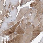 CD267 (TACI) Antibody in Immunohistochemistry (Paraffin) (IHC (P))