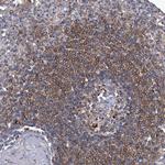 CD267 (TACI) Antibody in Immunohistochemistry (Paraffin) (IHC (P))
