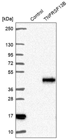 CD267 (TACI) Antibody in Western Blot (WB)