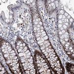 PCNA Antibody in Immunohistochemistry (Paraffin) (IHC (P))