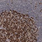 PCNA Antibody in Immunohistochemistry (Paraffin) (IHC (P))