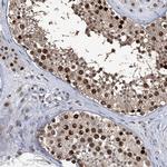 PCNA Antibody in Immunohistochemistry (Paraffin) (IHC (P))