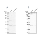 GRB2 Antibody in Western Blot (WB)