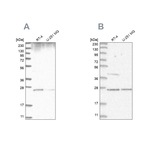 GRB2 Antibody in Western Blot (WB)