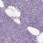 ADAM12 Antibody in Immunohistochemistry (Paraffin) (IHC (P))